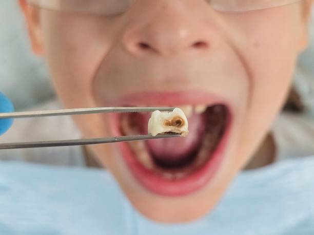 Best Emergency Dentist for Kids  in Glenwood, GA